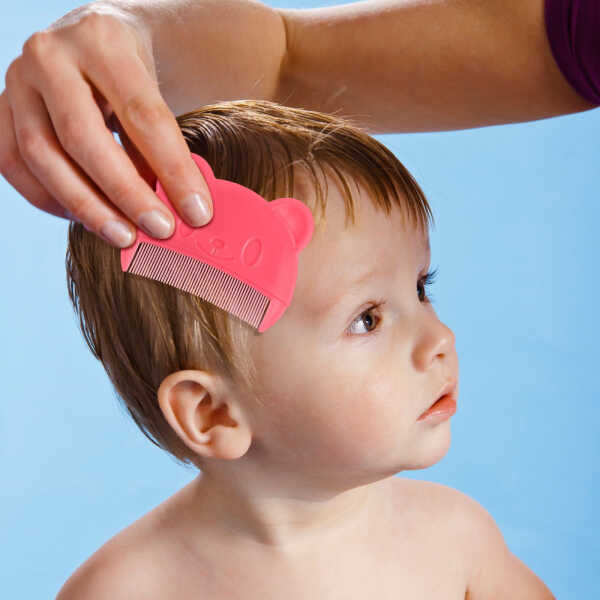 Masteelf 2 Pcs Baby Comb for Cradle Cap Grooming Kit Men and Women Toddler